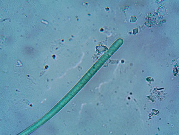 Was sind Nematoden bei Marihuanapflanzen? Sind sie nützlich oder schädlich? Was sind Nematoden bei Marihuanapflanzen? Sind sie nützlich oder schädlich?